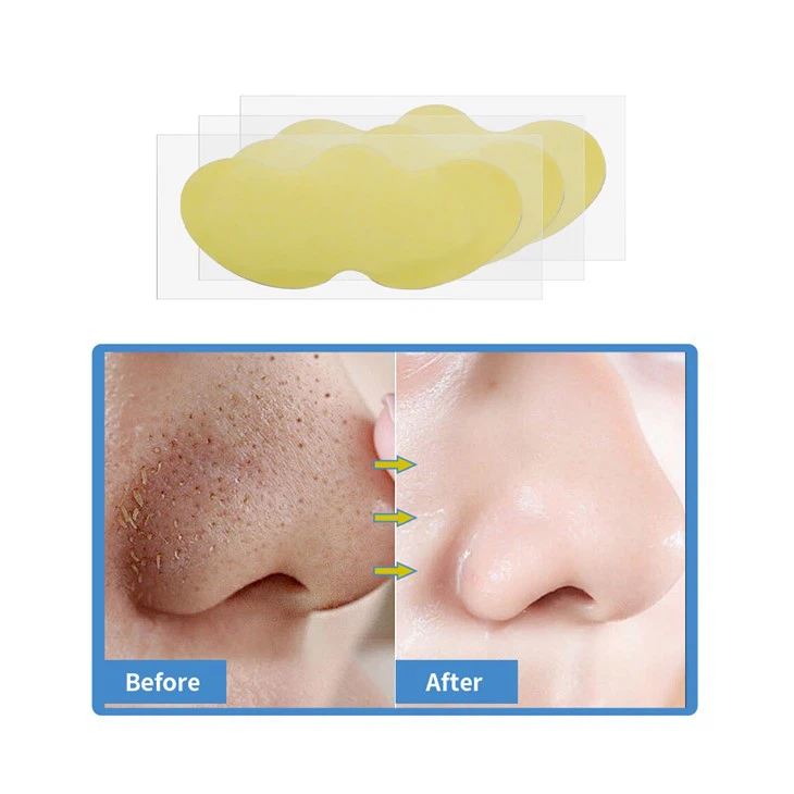 nose strips (13)